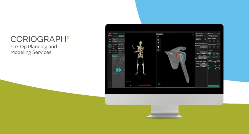 Smith+Nephew Releases Coriograph Pre-Op Services for Shoulder
